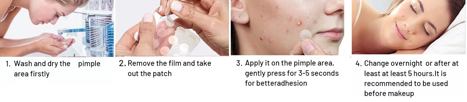 pimple patch